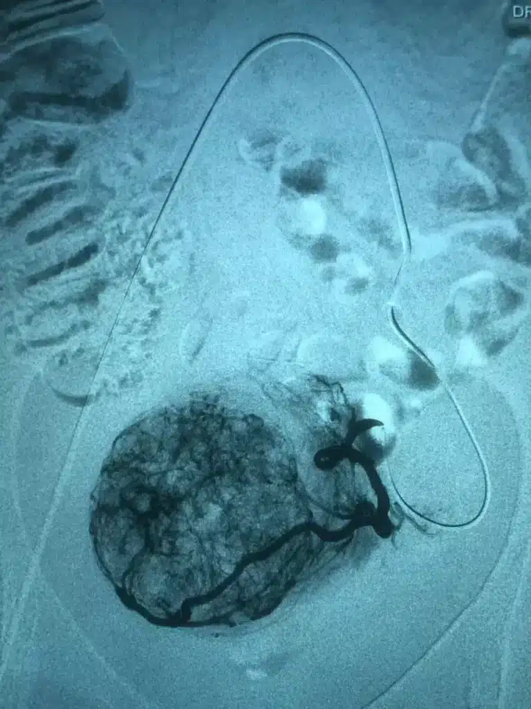 Dr. Bernardo Pacheco - Inovação em cirurgia minimamente invasiva