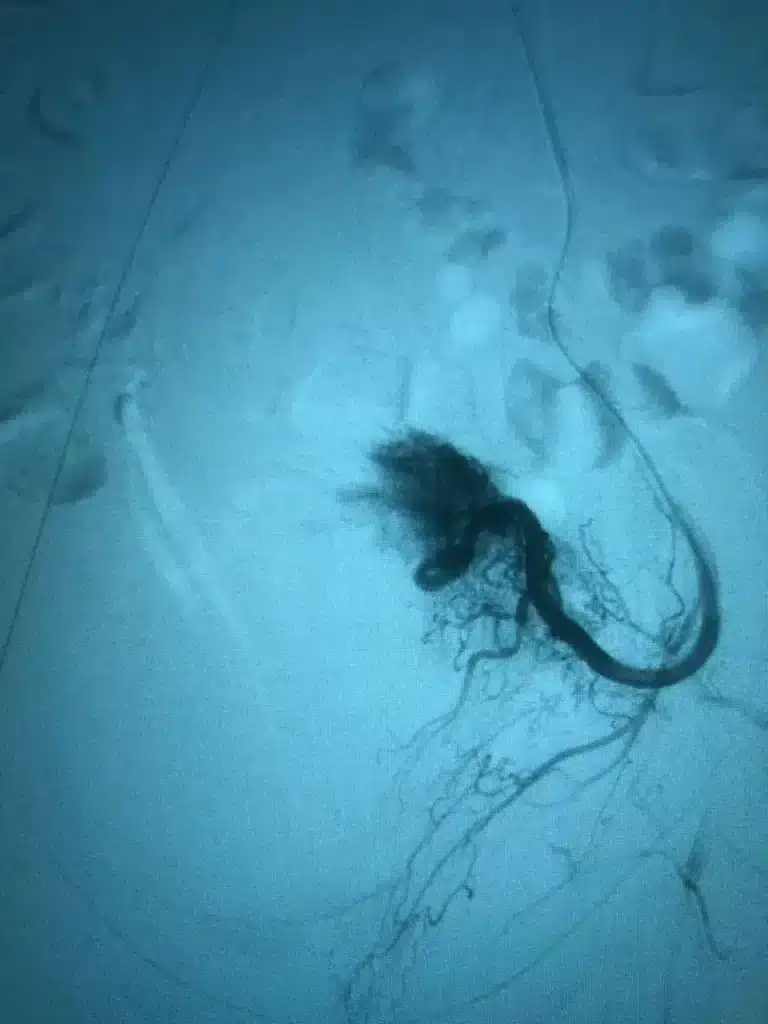 Dr. Bernardo Pacheco - Inovação em cirurgia minimamente invasiva